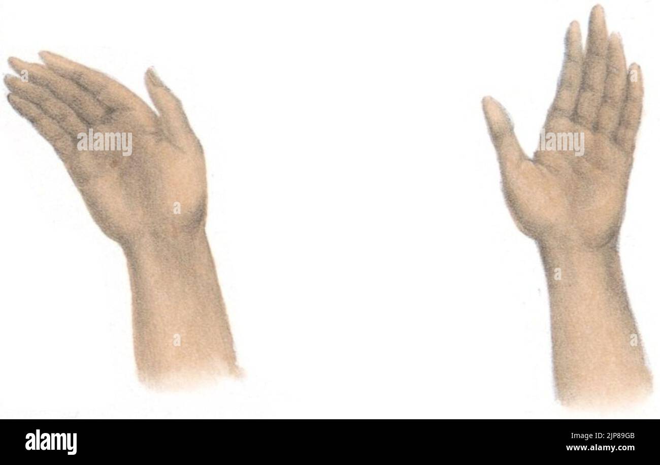 Внутренний край. Фиг 4. Трафарет рука с наложенной манжеткой. Фиг 4. Фига рисунок.