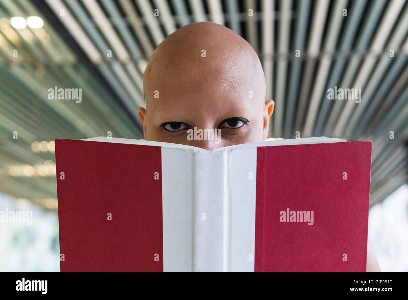 baldness, disease, hair loss, alopecia universalis, body positivity