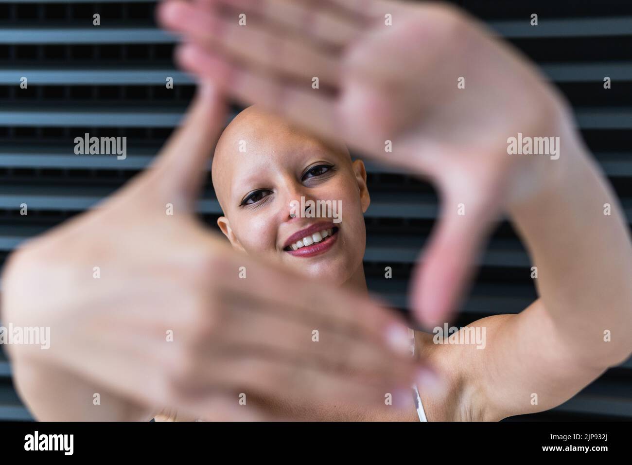 individuality, gesture, hair loss, alopecia universalis, body positivity, alopecia, keine haare, tumorbehandlung, individualities, gestures Stock Photo