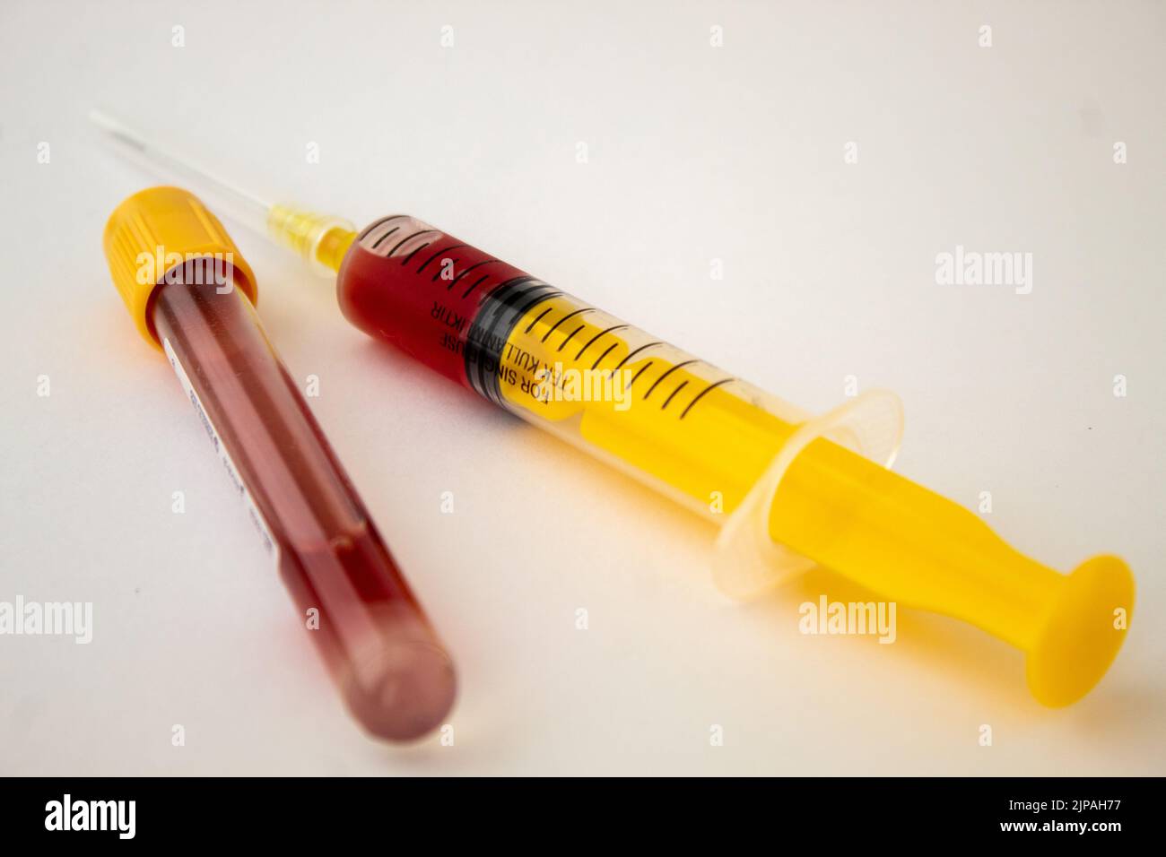 A yellow syringe with blood and a yellow capped blood test tube