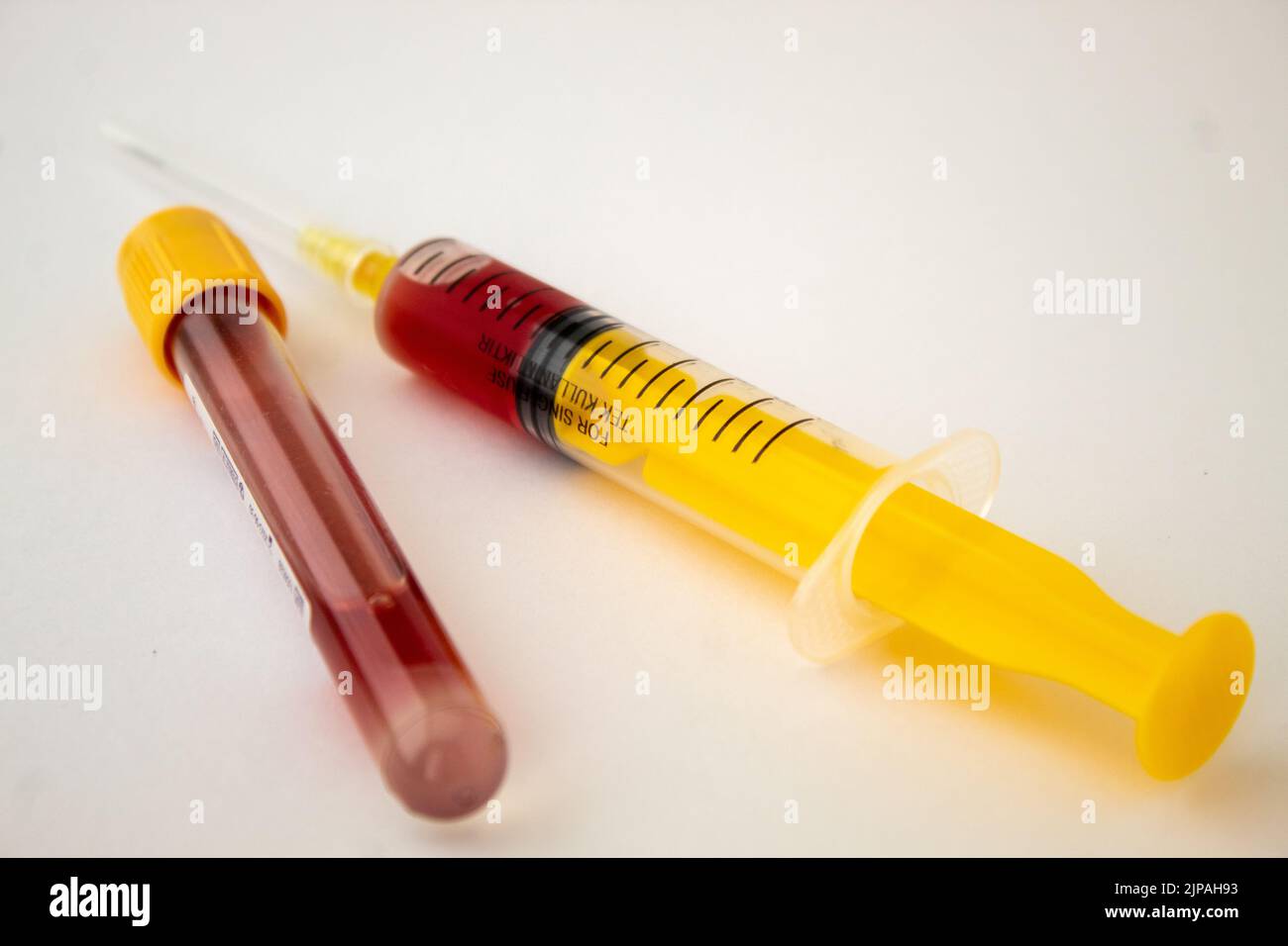 A yellow syringe with blood and a yellow capped blood test tube