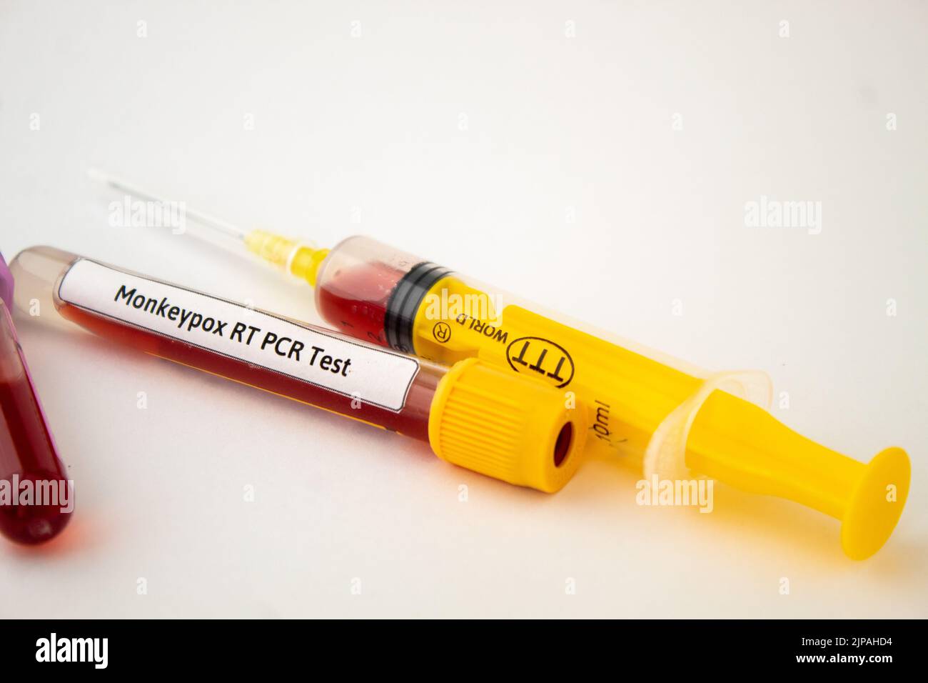 Blood tests for monkeypox virus, yellow syringe and blood test tube