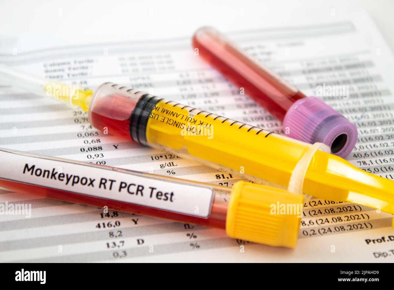 Blood tests for monkeypox virus, yellow syringe and blood test tubes on