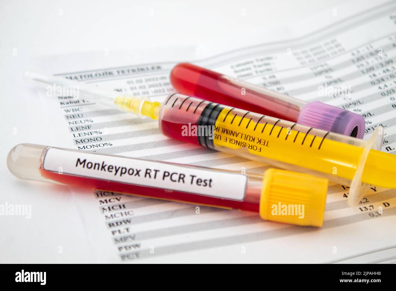 Blood tests for monkeypox virus, yellow syringe and blood test tubes on