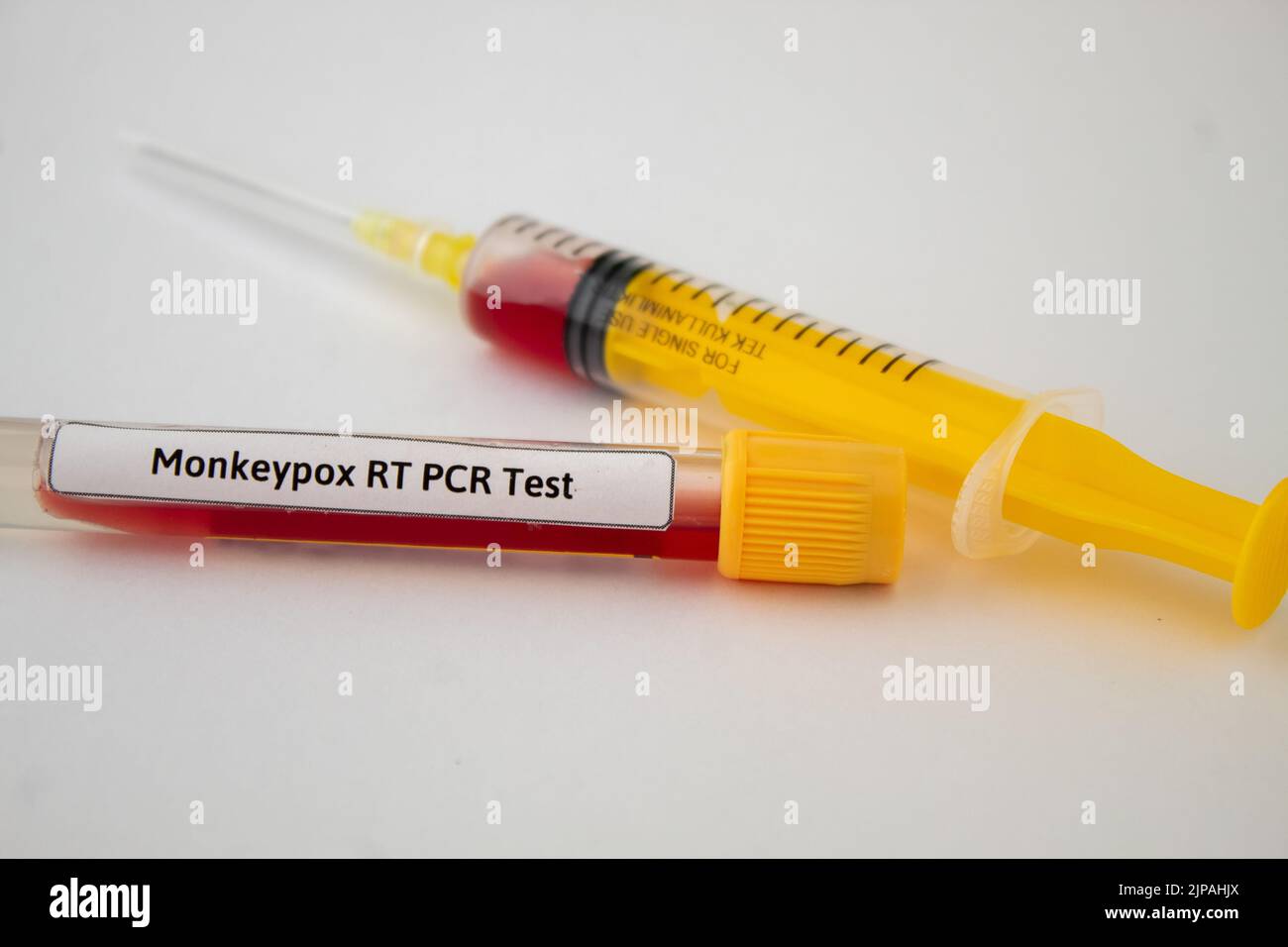 Blood tests for monkeypox virus, yellow syringe and blood test tube