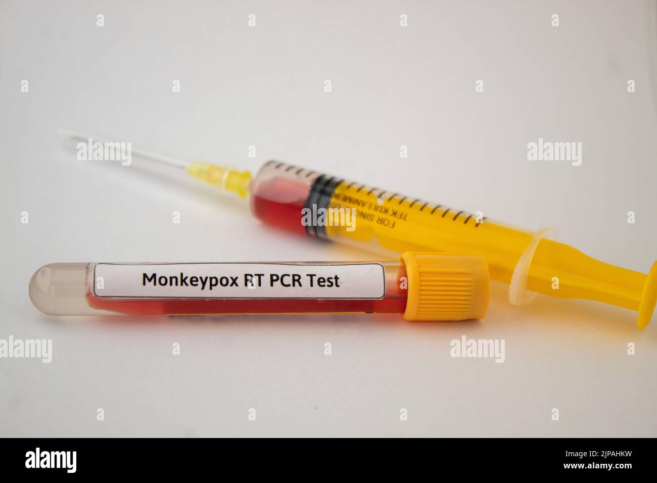 Blood tests for monkeypox virus, yellow syringe and blood test tube