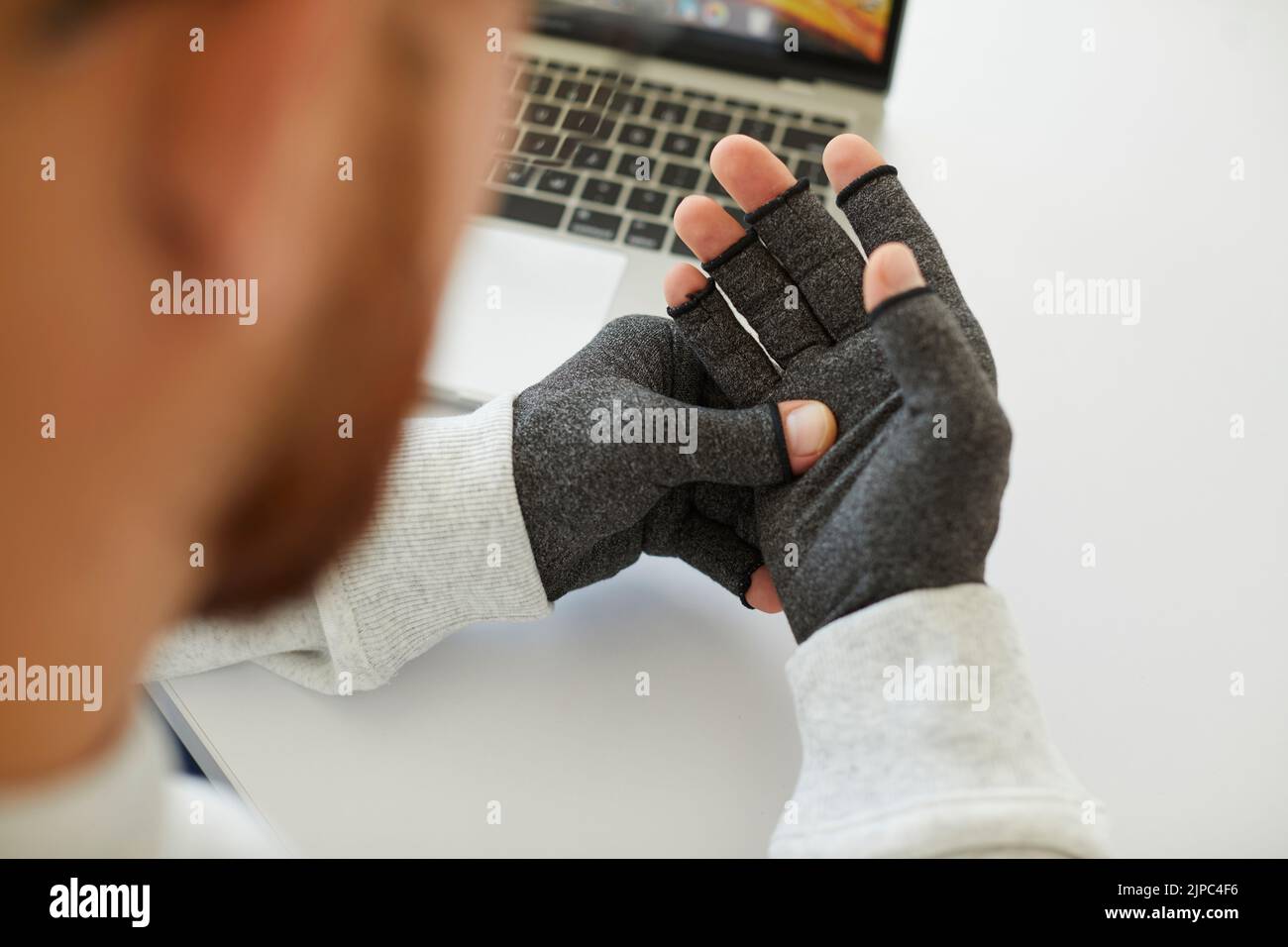 Young man who has rheumatoid arthritis wears compression gloves for relieving pain Stock Photo
