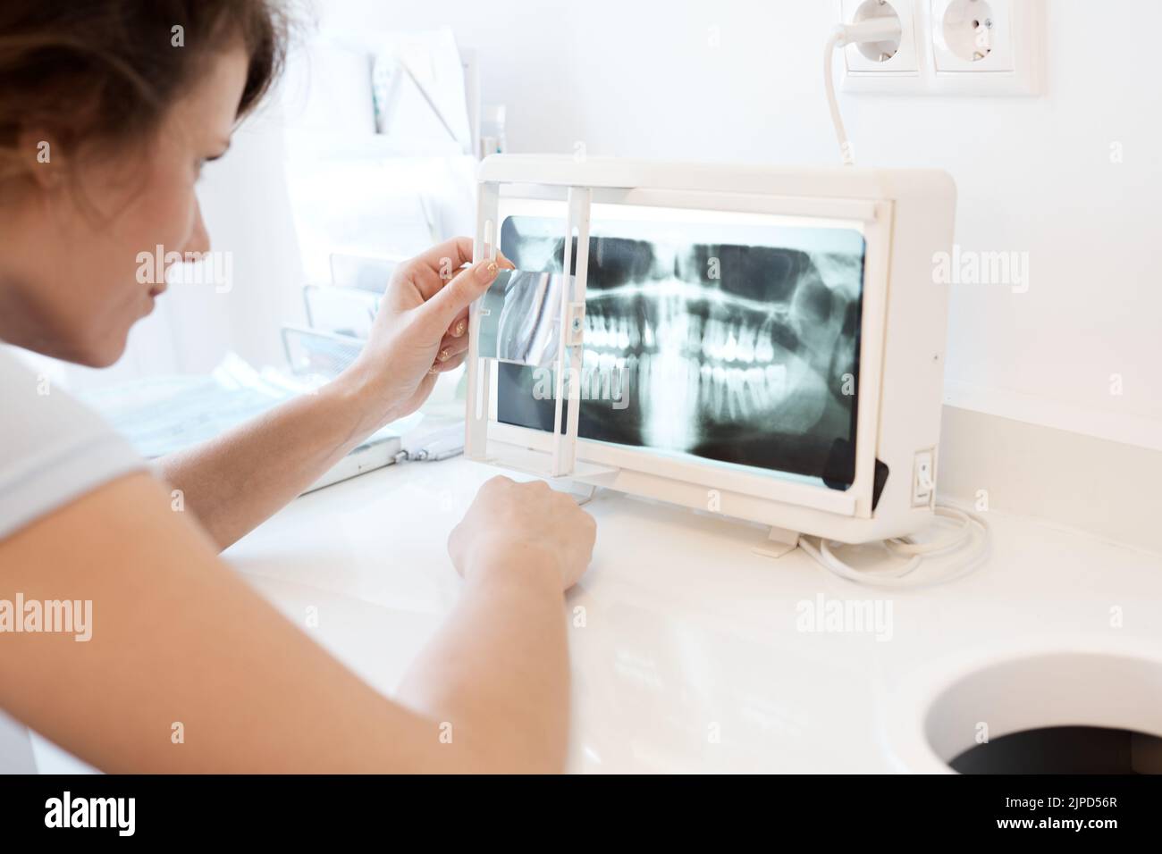 dentition, x-ray image, diagnosis, dentitions, radiology, x-rays, xray ...