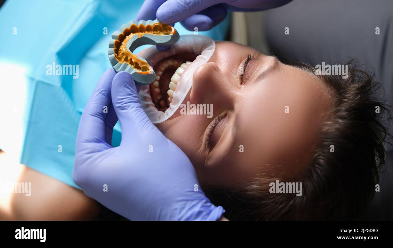 Simulation of artificial teeth on plaster model and patient with open