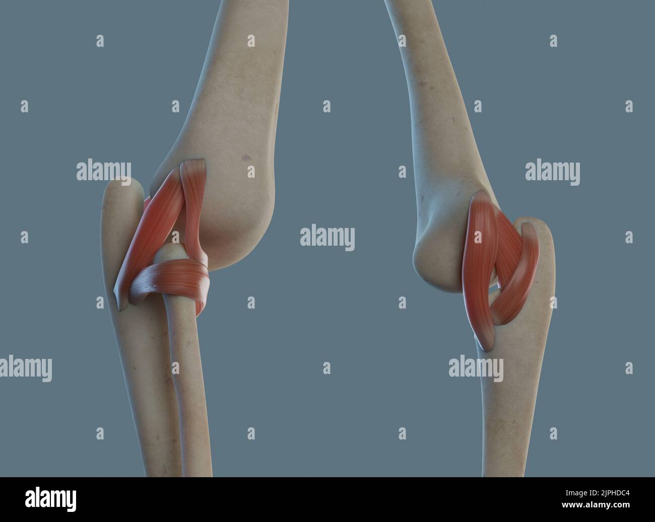 Elbow joint anatomy, including ligaments and bones. Multiple angles ...