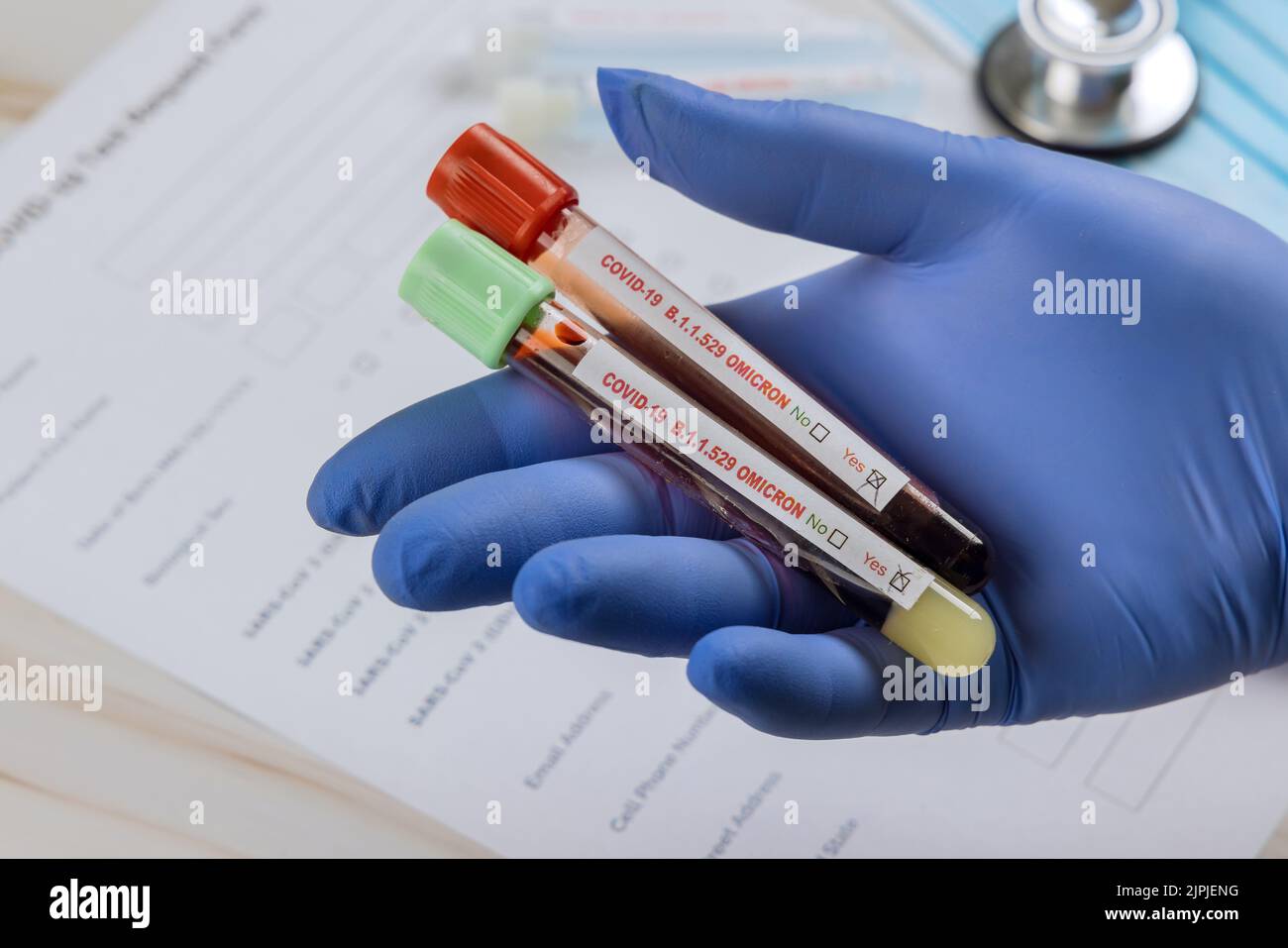 blood sample, covid19, omicron, coronavariante, blood samples Stock