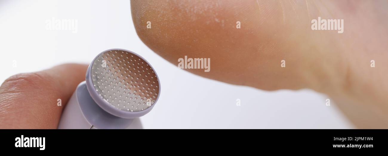 Callus peeling using professional pedicure drill machine. spa foot treatment Stock Photo Alamy