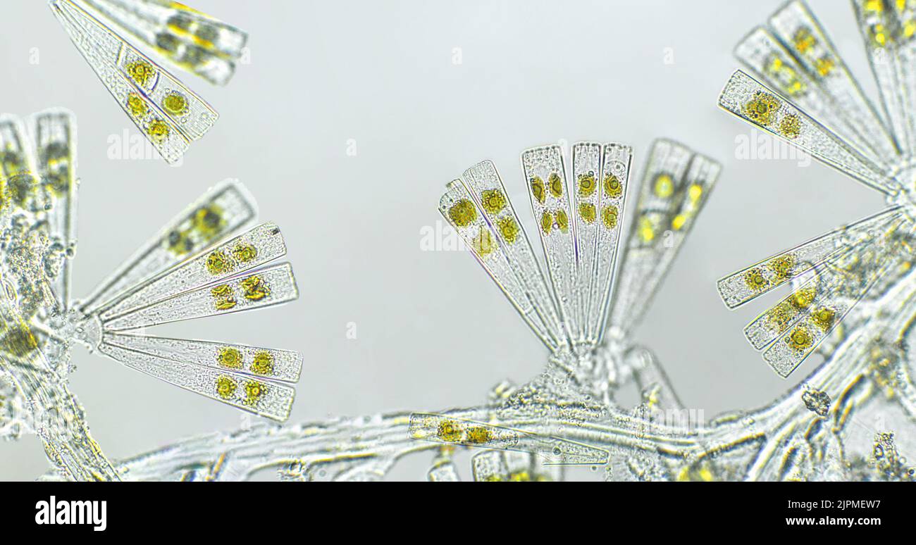 Licmophora sp. algae, marine and freshwater diatom under microscopic view. Genus of benthic, photosynthetic and epiphyte diatom Stock Photo