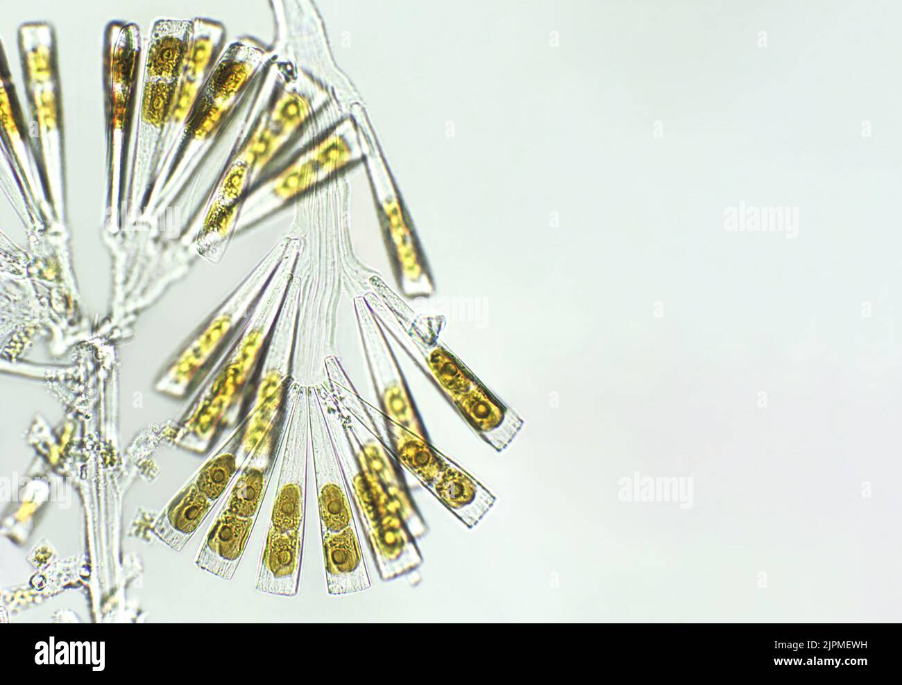 Licmophora sp. algae, marine and freshwater diatom under microscopic