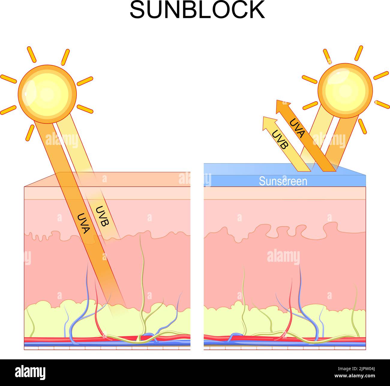 skin protection before and after Sunscreen. sunblock. sun cream. UV rays penetration into the layers of the human skin. UVB blocked by the epidermis. Stock Vector