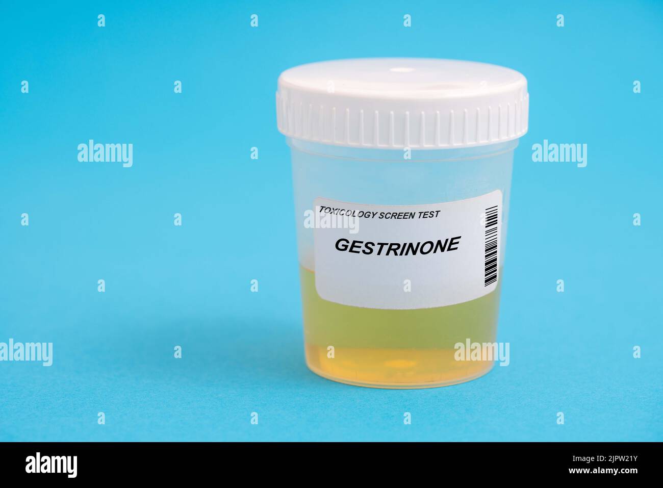 Gestrinone. Gestrinone toxicology screen urine tests for doping and