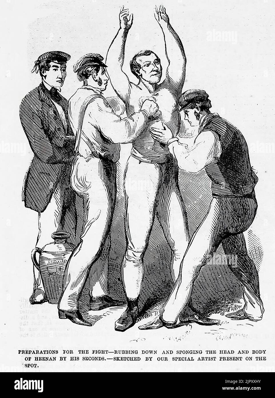 Preparations for the fight - Rubbing down and sponging the head and body of John C. Heenan by his seconds, April 17th, 1860. 19th century illustration from Frank Leslie's Illustrated Newspaper Stock Photo
