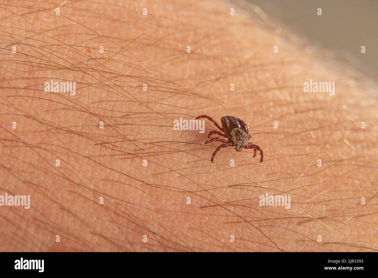 close-up deer tick trying to bite through human skin. Danger Infection through the bite of a dangerous insect that causes Borrelia disease. Stock Photo