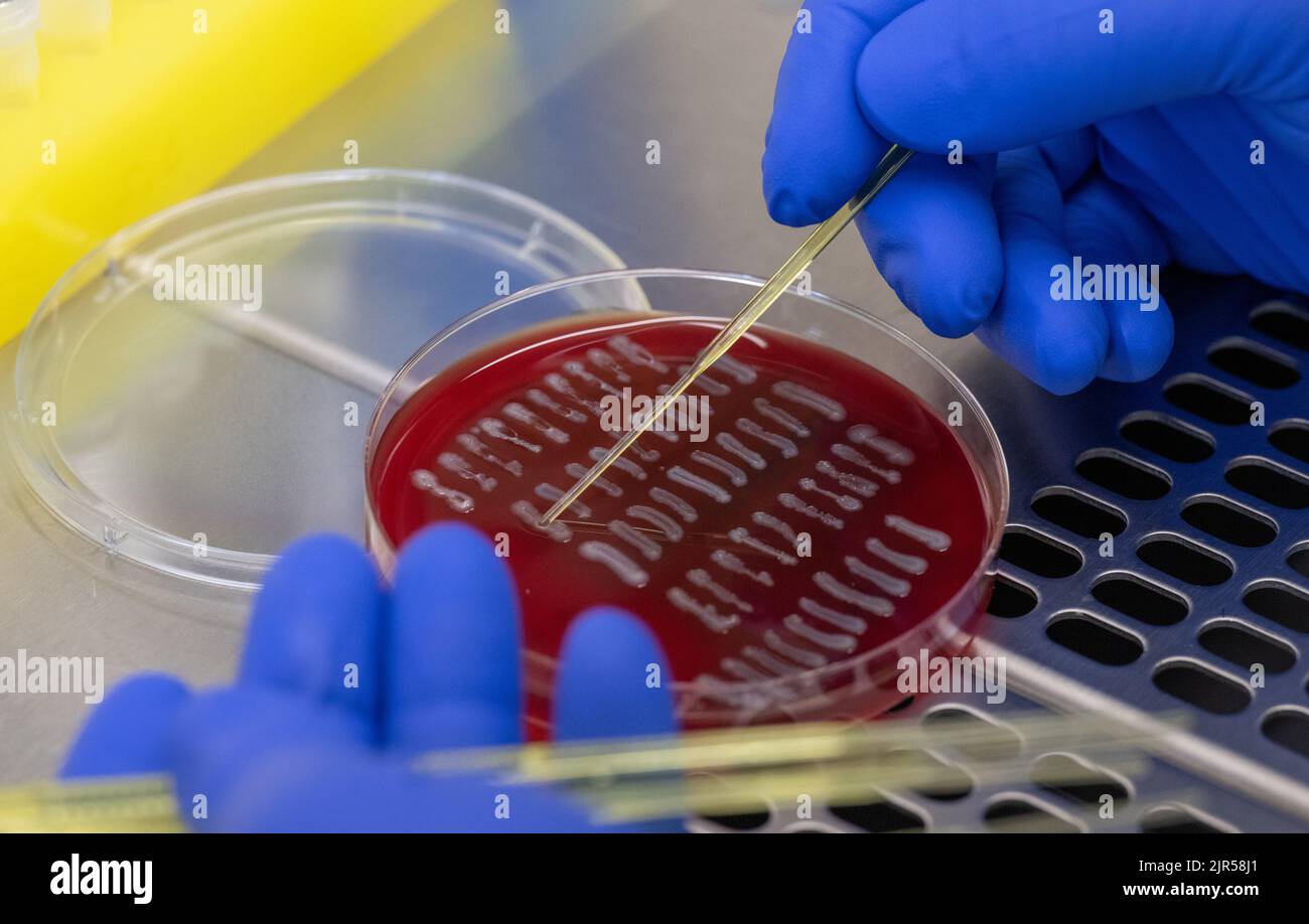 22 August 2022, Saxony, Chemnitz: A medical-technical assistant ...