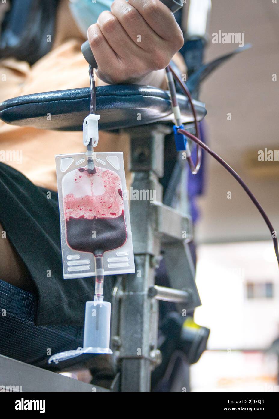 Blood donor in the midst of donating blood, close up shot. Stock Photo