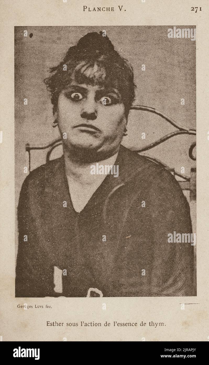 Portrait of a female subject named 'Esther,' who during an  neuropsychiatric experiment by French neurologist Jules Bernard Luys (1828 - 1897), displays an intense emotional reaction under exposure to essence of thyme, France, 1890. The caption under the photograph reads 'Ester sous l'action de l'essence de thym'  Photography by Georges Luys (1870 - 1953). Stock Photo