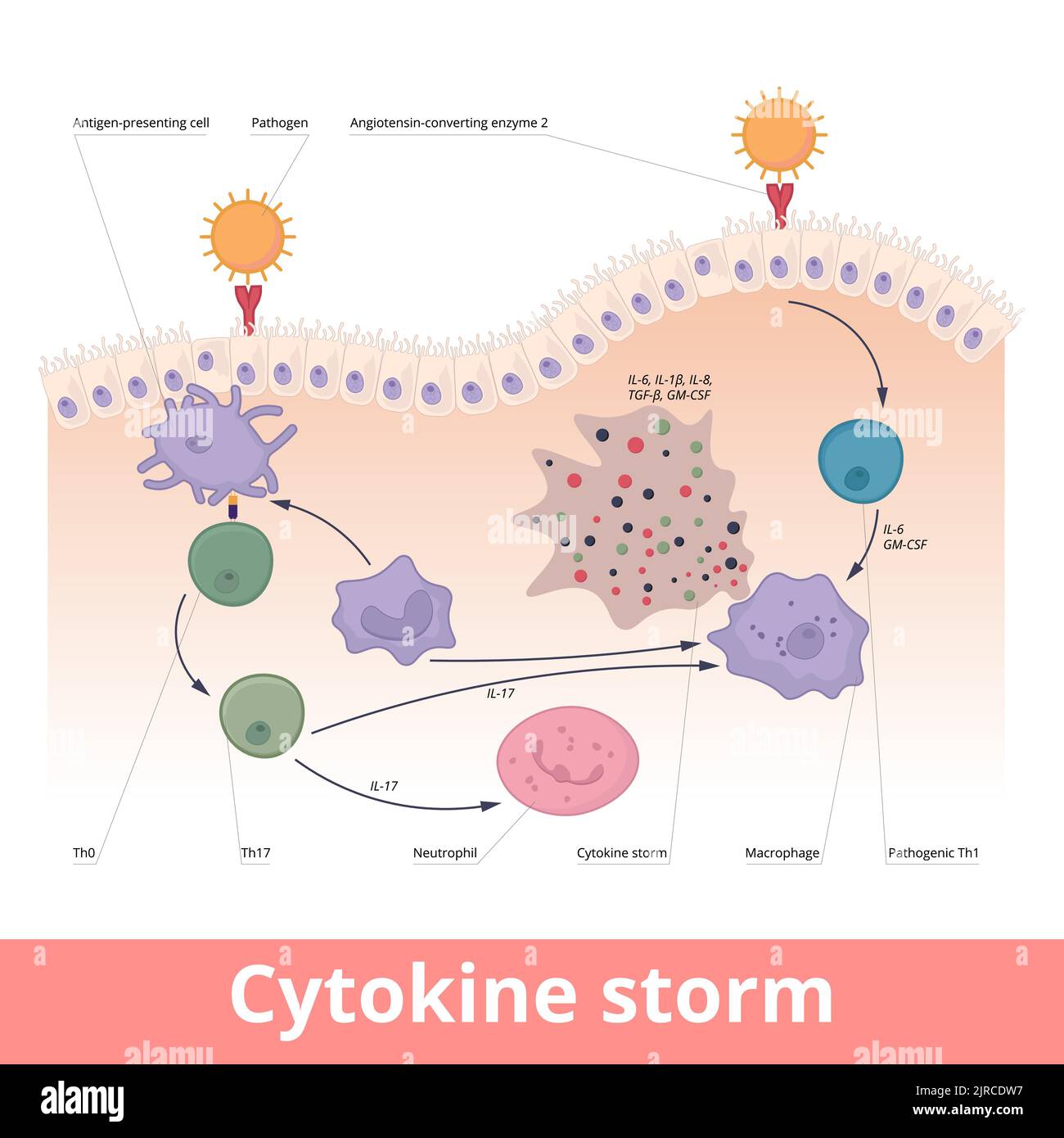 Cytokine storm. Hypercytokinemia during which the immune system causes a release of cytokines with help of macrophages, t helper cells, neutrophils. Stock Vector