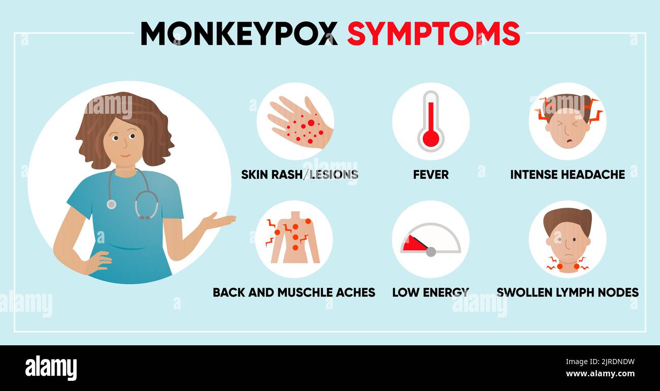 Monkeypox virus symptoms simple infographic. Poster for social media, articles and flyers. Vector illustration. Stock Vector