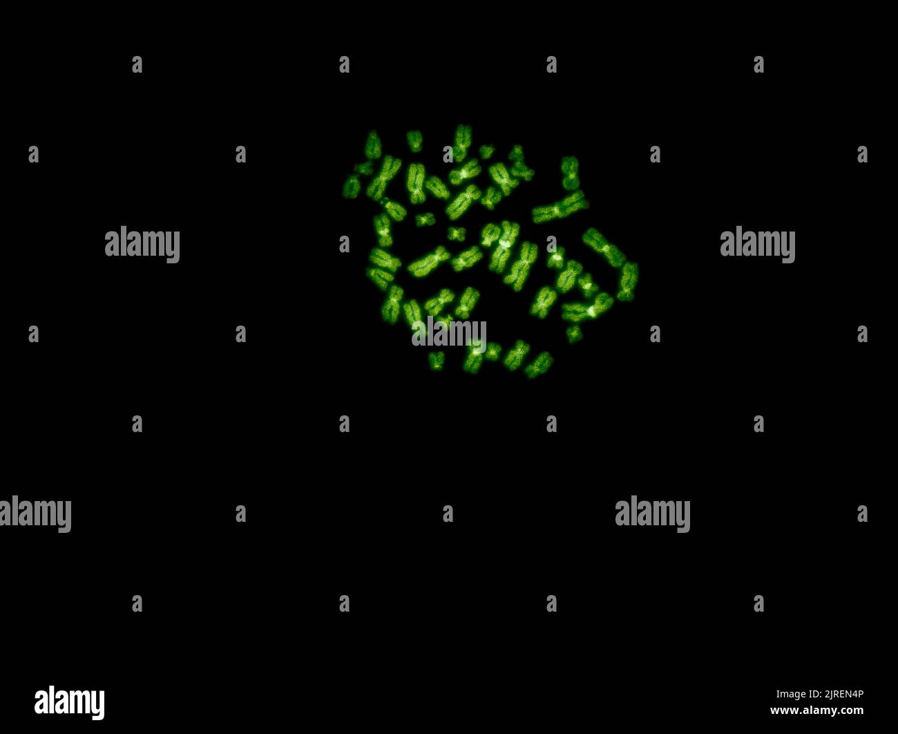 Chromosomes under fluorescence microscope, green colored Human chromosomes from blood Stock Photo