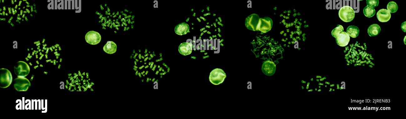 Chromosomes under fluorescence microscope, green colored Human chromosomes from blood Stock Photo