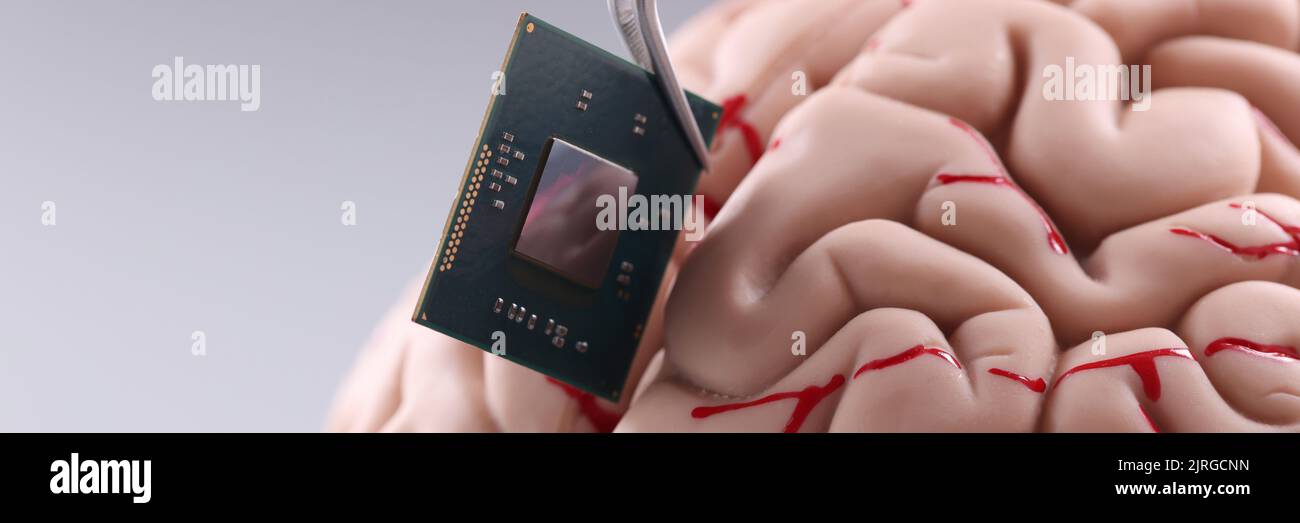 Tiny Computer Chip Someone put tiny computer chip detail in human brain Stock Photo - Alamy