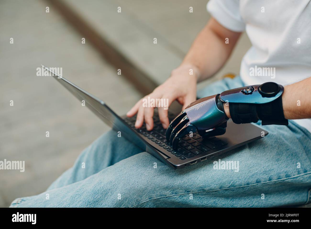 Young disabled man with artificial prosthetic hand using typing on laptop computer keyboard