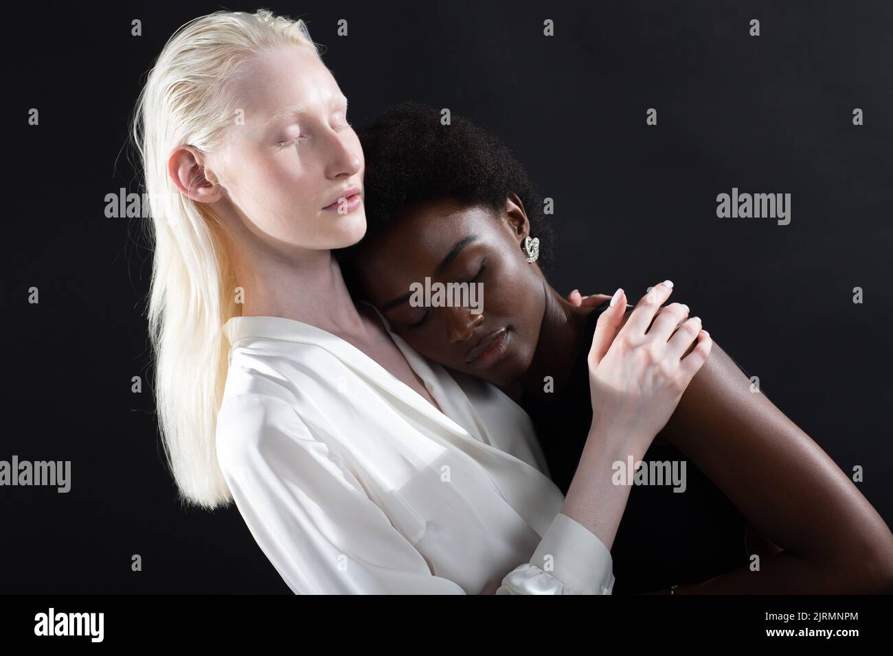 Caucasian albino girl and african american young woman hugging on black ...