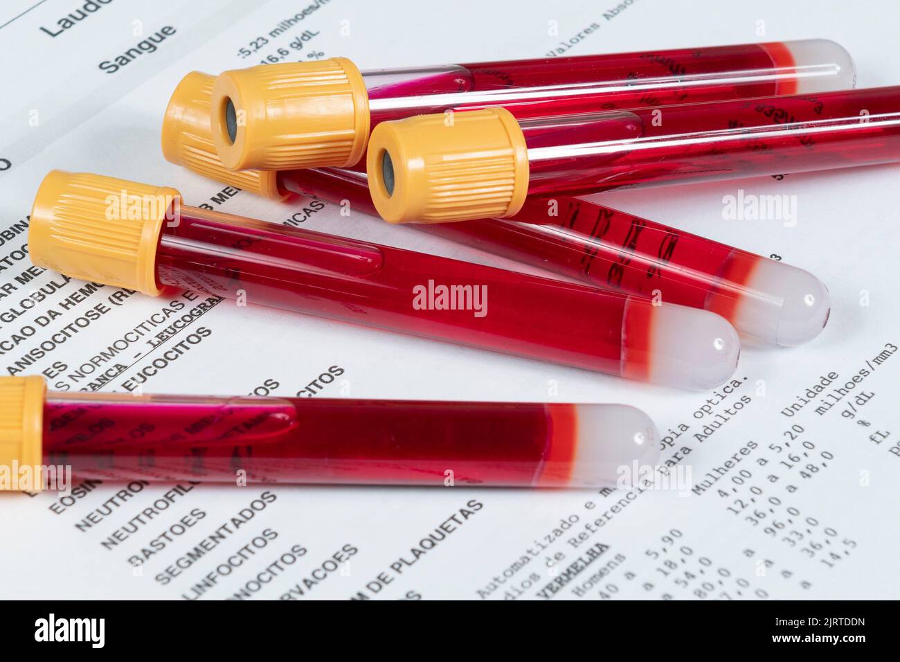 Hematology test sheet hi-res stock photography and images - Alamy