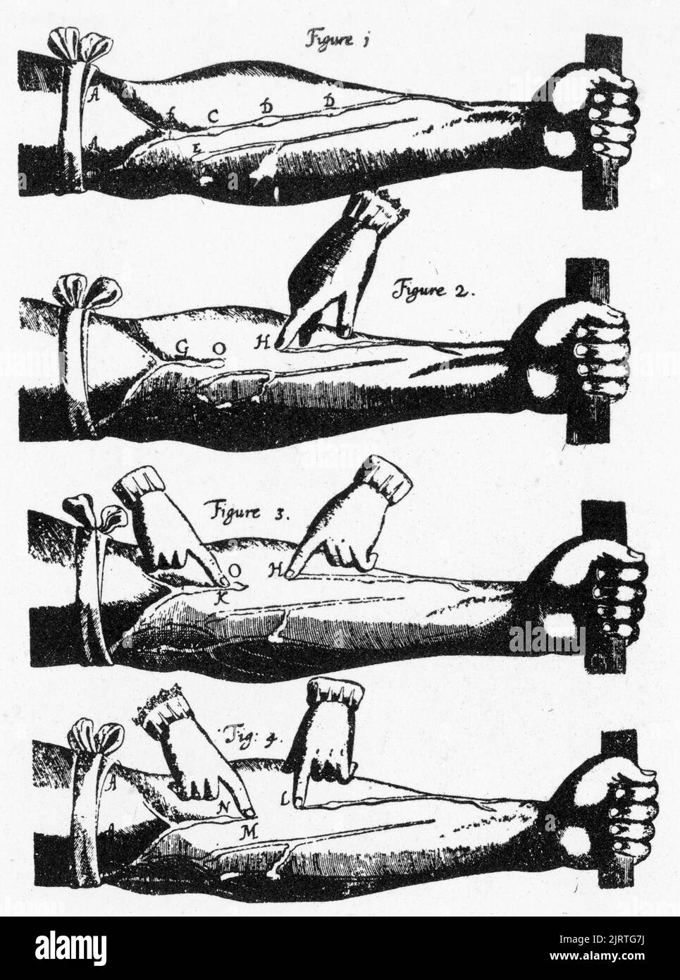 Diagrams illustrating William Harvey's experiments on a bandaged arm, 1628. Exercitatio Anatomica de Motu Cordis et Sanguinis in Animalibus (An Anatomical Exercise on the Motion of the Heart and Blood in Living Beings), commonly called De Motu Cordis, is the best-known work of the physician William Harvey (1578-1657), which was first published in 1628 and established the circulation of blood throughout the body. Stock Photo