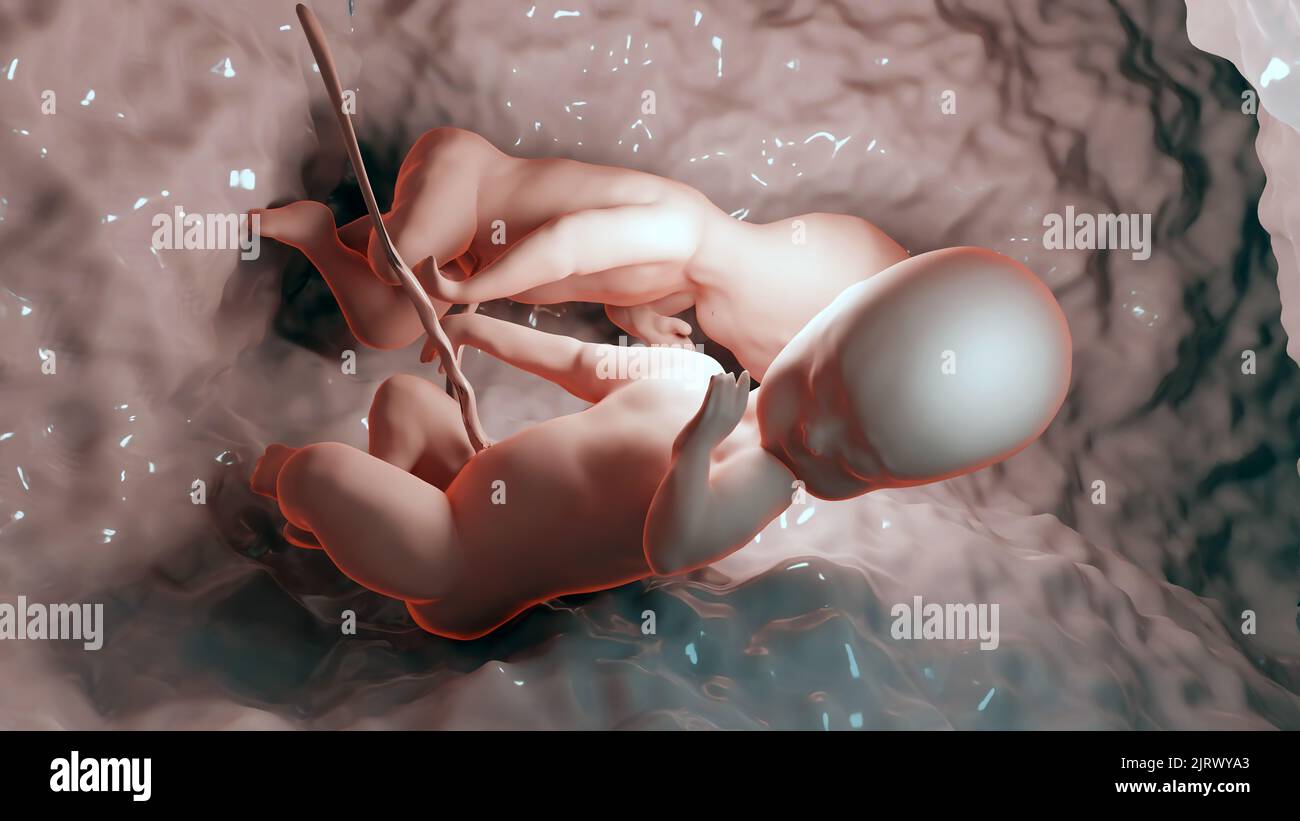 3d rendered medically accurate illustration of twins in the womb, Monozygotic twins in uterus with single placenta, Human twin fetuses, prenatal growi Stock Photo