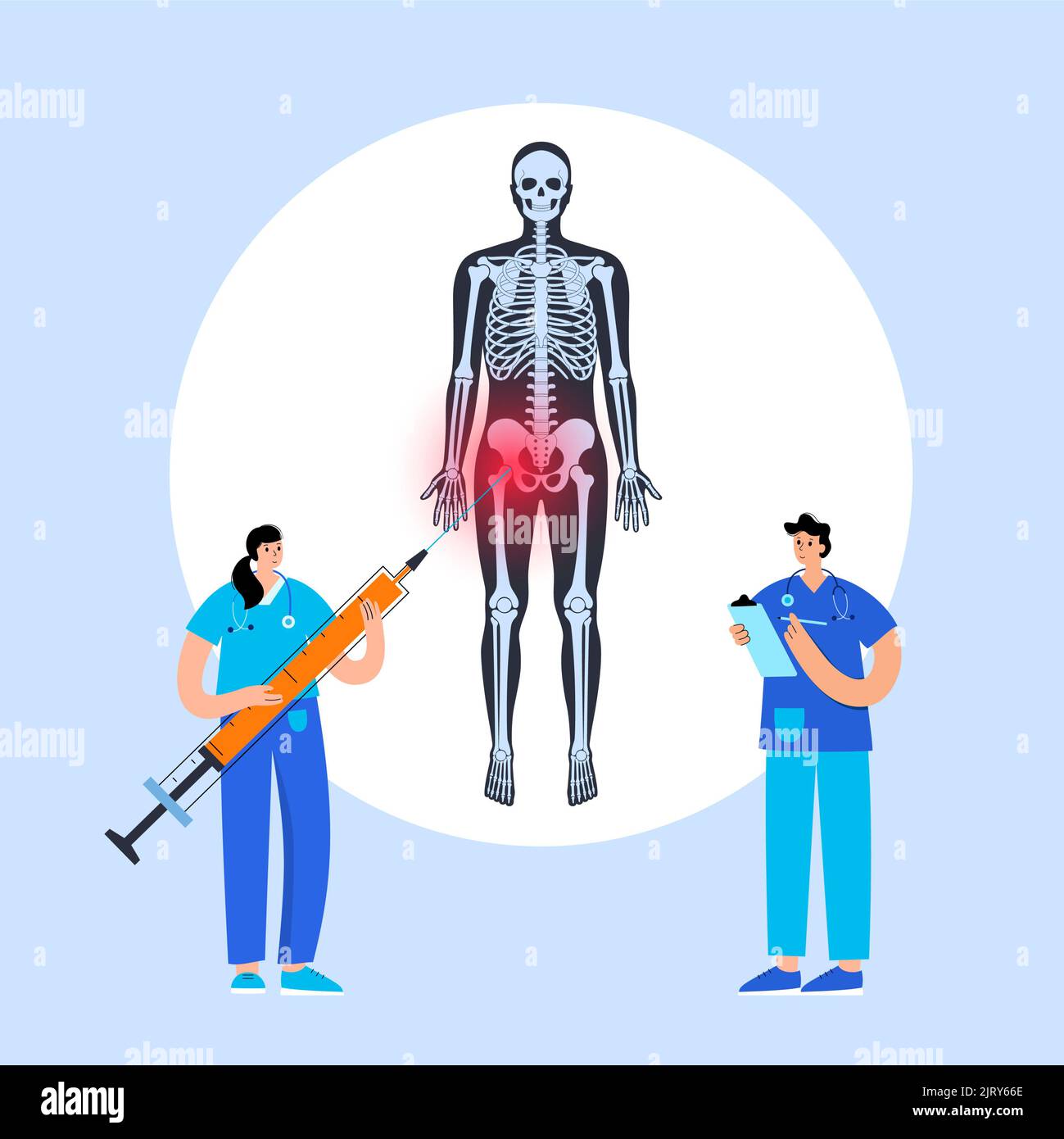 Hip joint injection, illustration Stock Photo Alamy