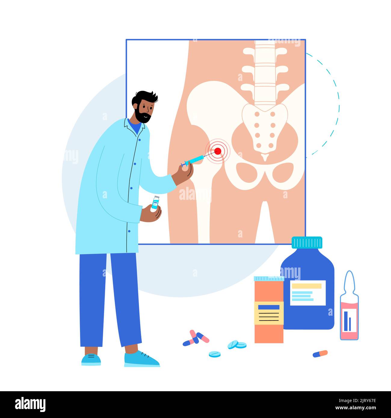 Hip joint injection, illustration Stock Photo Alamy