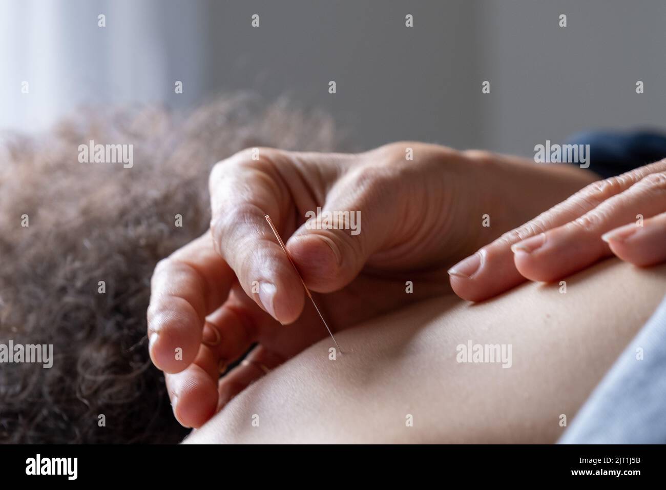 Profesional woman giving acupuncture treatment. High quality photo ...