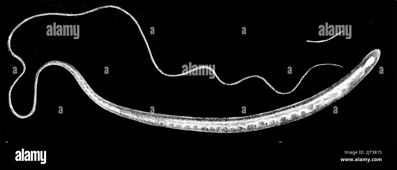 Trichuris trichiura, female. Stock Photo