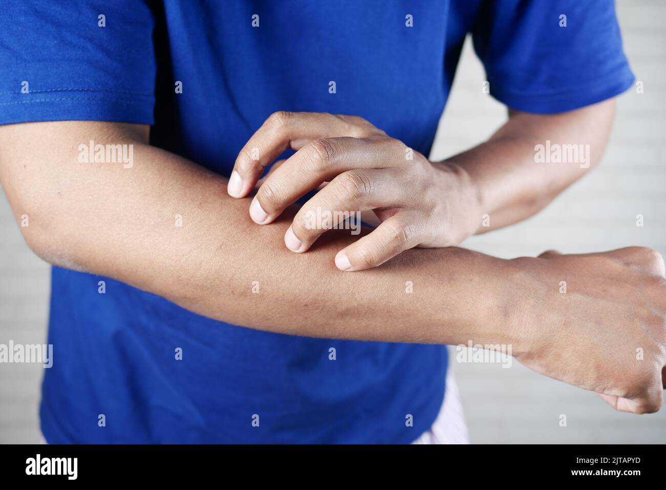 Man suffering from itching hi-res stock photography and images - Alamy