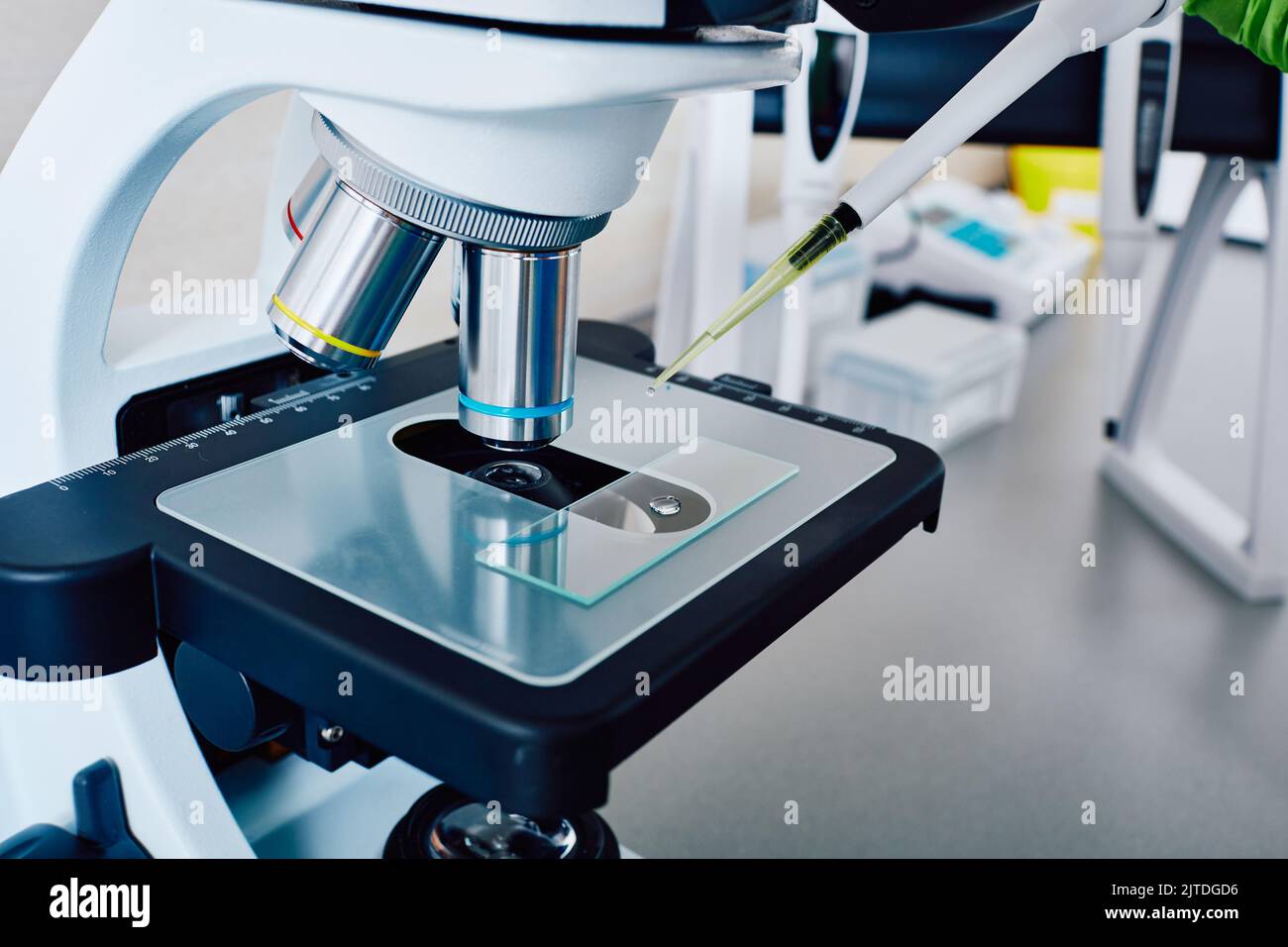 Microscopic urinalysis. Research of urine test sample under medical