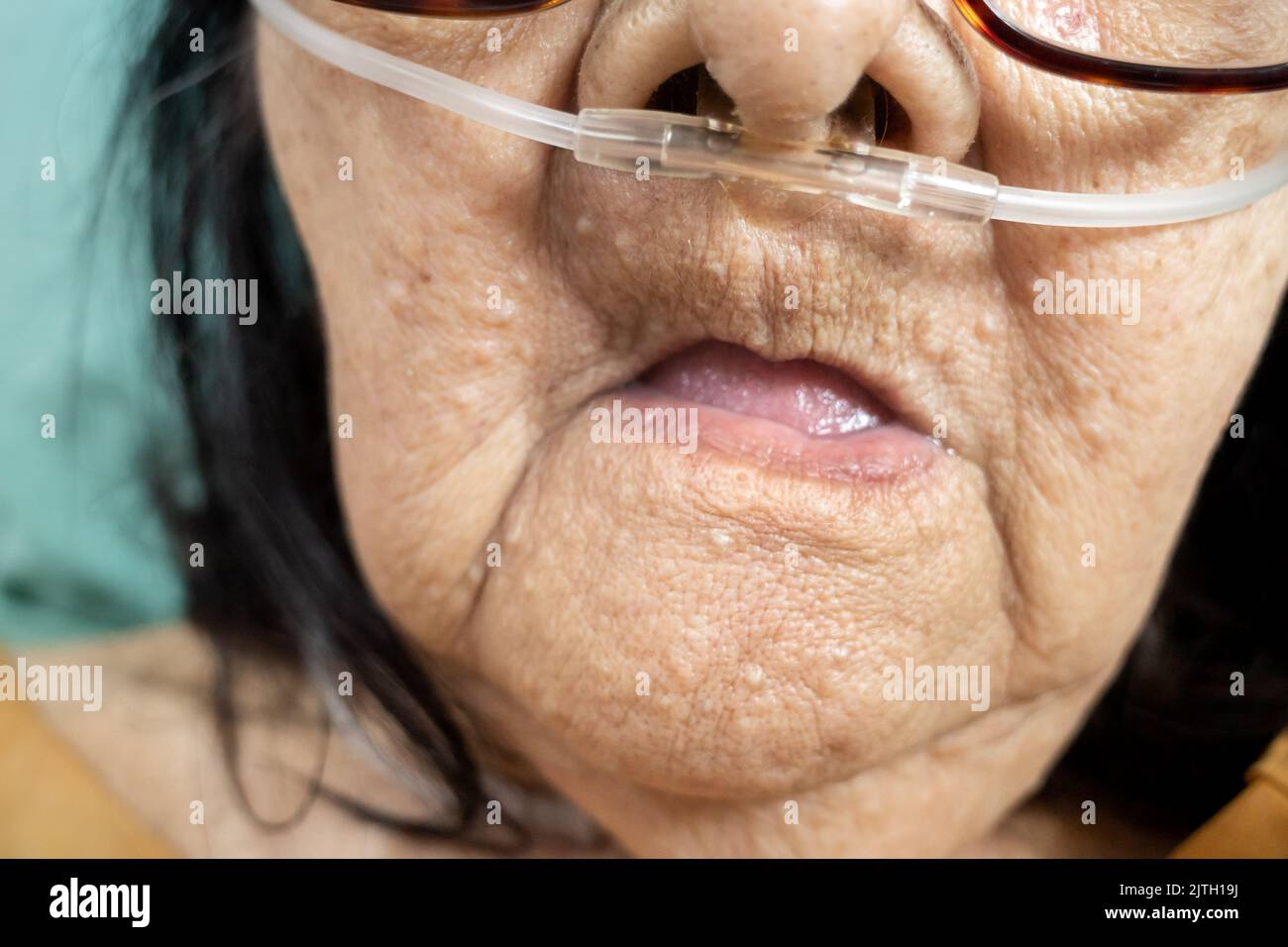 Closeup face of hospitalized Asian female senior patient with respiratory disorders using oxygen nasal cannula in hospital Stock Photo