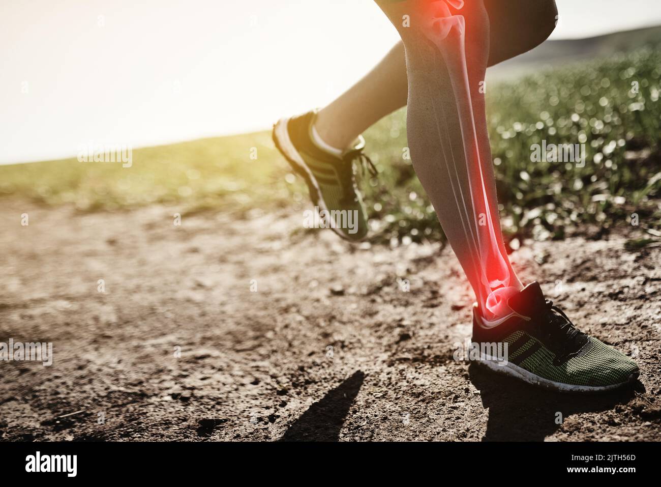 Suffering from shin splints. an unrecognizable man running with an injury highlighted by cgi