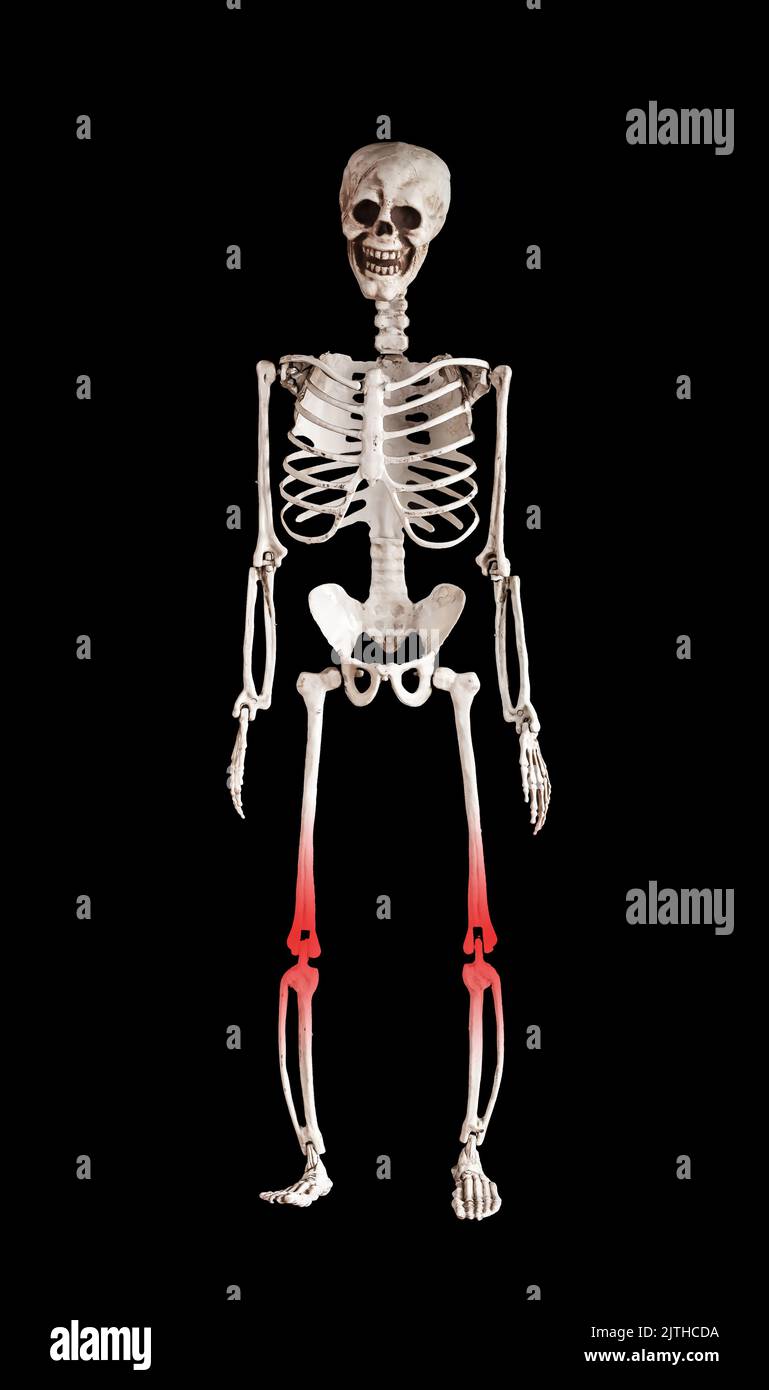 Human skeleton with red knees. Leg pain caused by overuse, injury