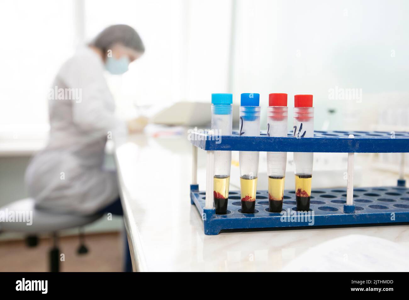 Blood transfusion station.Nurse with blood tests.Blood in test tubes