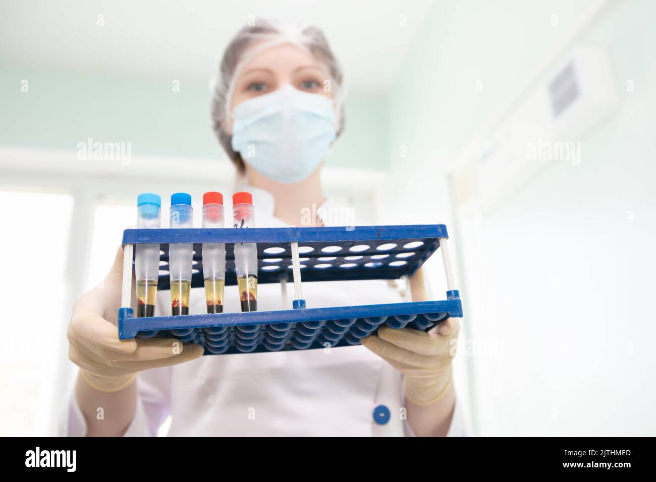 Blood transfusion station.Nurse with blood tests.Blood in test tubes