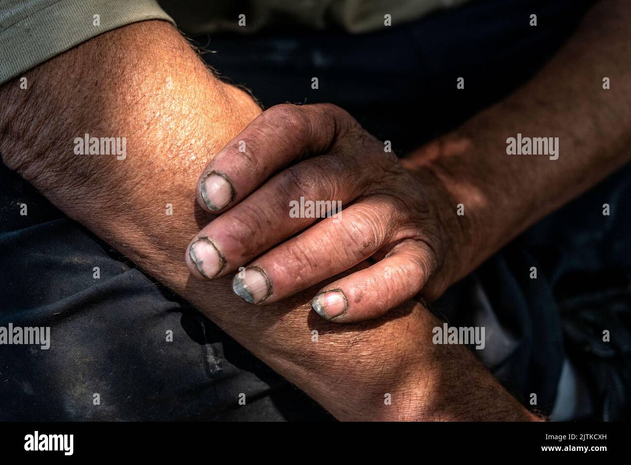 Vacaville, California, USA. 27th July, 2022. MARK RIPPEE'S fingernails reflect his life living on the streets of Vacaville. His 65-year-old twin sisters who do not have a car, try to visit and care for him when they can. (Credit Image: © Renee C. Byer/Sacramento Bee/ZUMA Press Wire) Stock Photo