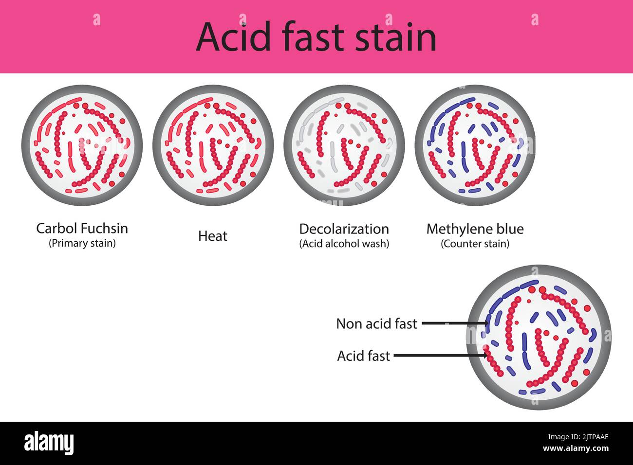 Acid fast staining microbiology lab technique steps diagram, using Carbol fuchsine and methylene blue vector illustration eps10 Stock Vector