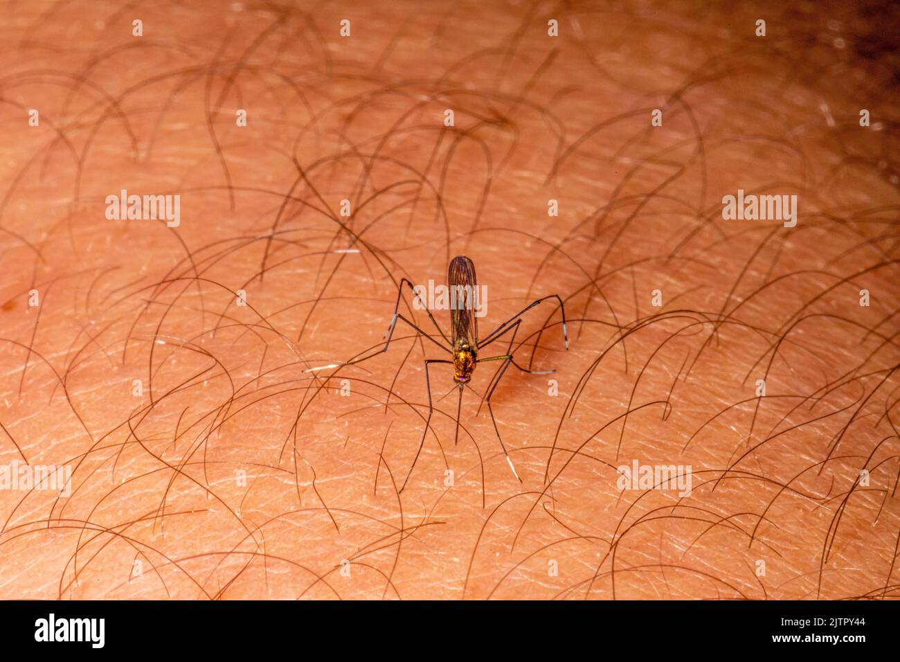 Gnat stinging human arm, plague Stock Photo - Alamy