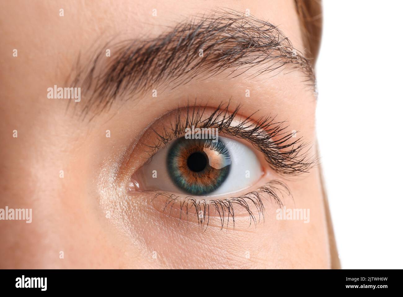 Young woman with heterochromia iridum, closeup Stock Photo